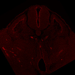Protein expression in the human embryonic spinal cord