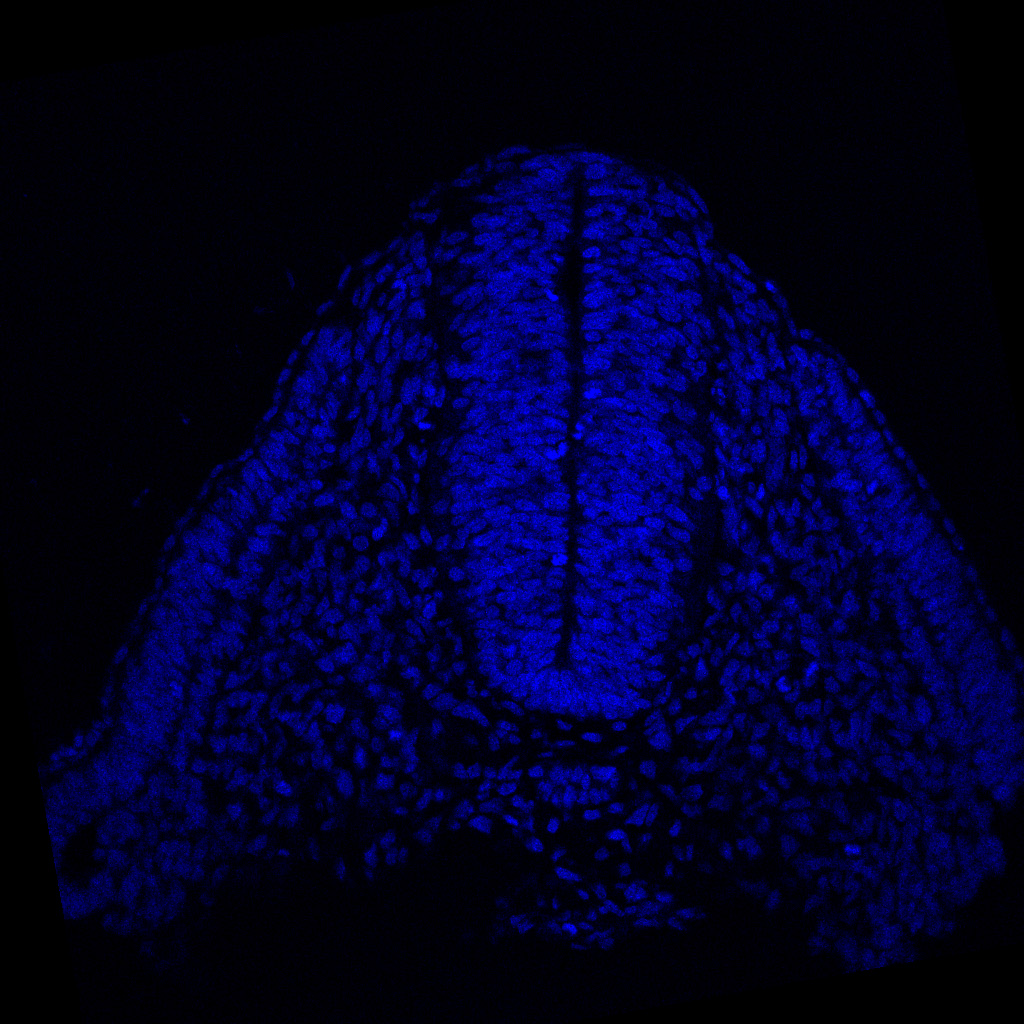 Protein expression in the human embryonic spinal cord