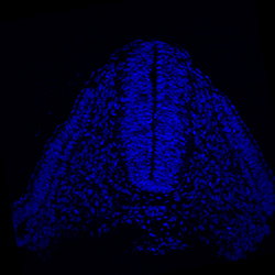 Protein expression in the human embryonic spinal cord