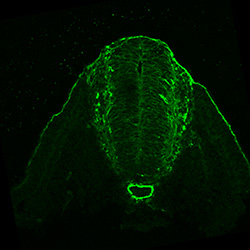 Protein expression in the human embryonic spinal cord