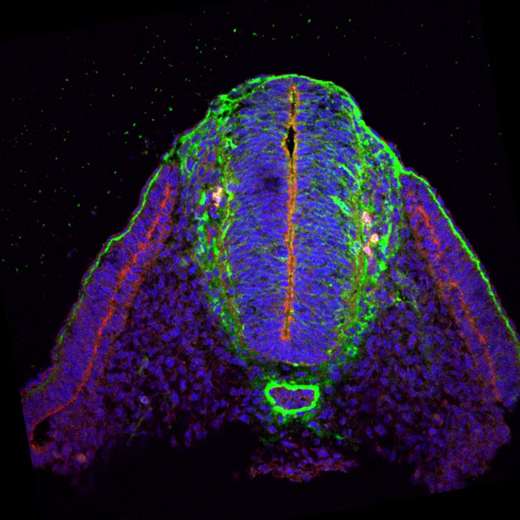 Protein expression in the human embryonic spinal cord