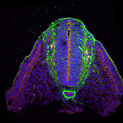 Protein expression in the human embryonic spinal cord
