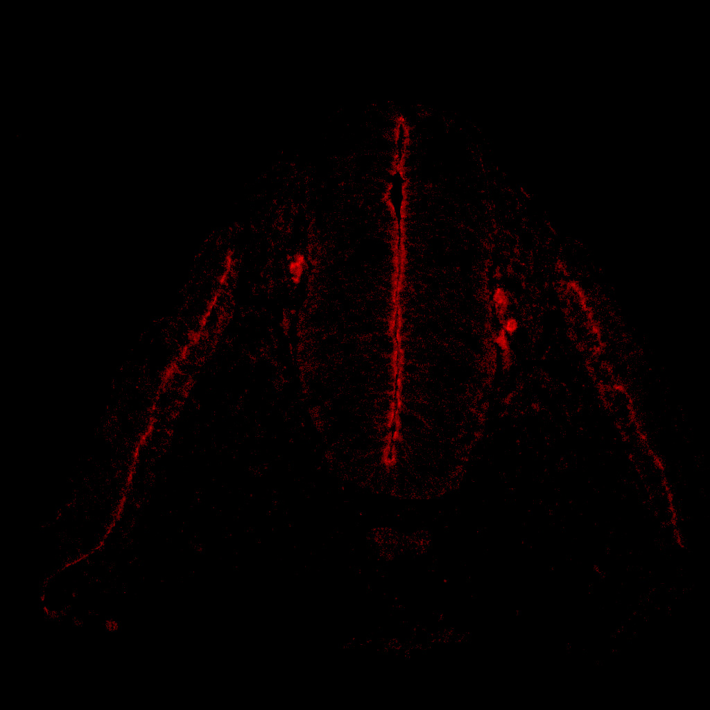 Protein expression in the human embryonic spinal cord