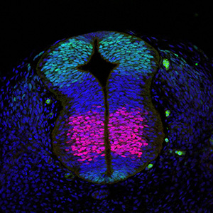 Gene expression in a human embryo