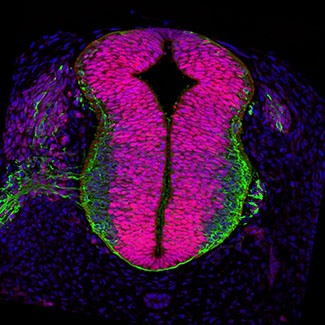 Gene expression in the human embryonic spinal cord