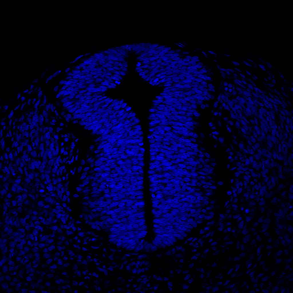 Protein expression in the human embryonic spinal cord