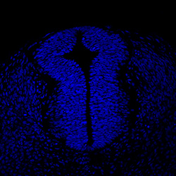 Protein expression in the human embryonic spinal cord
