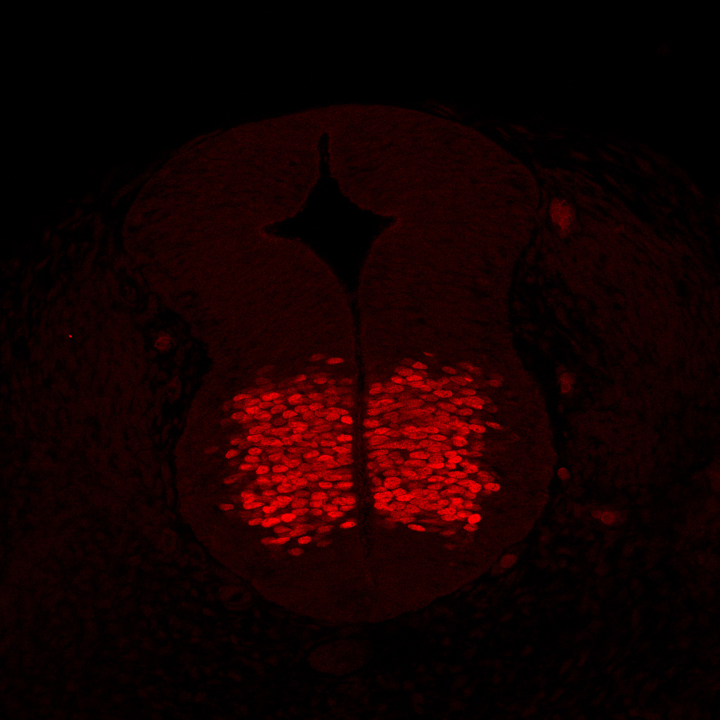 Protein expression in the human embryonic spinal cord