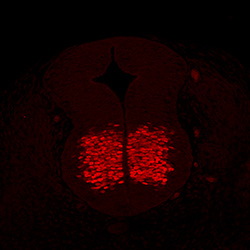Protein expression in the human embryonic spinal cord