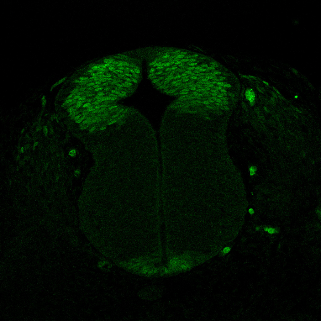 Protein expression in the human embryonic spinal cord