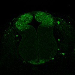 Protein expression in the human embryonic spinal cord