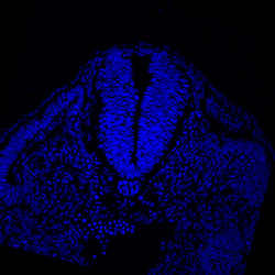 Protein expression in the human embryonic spinal cord