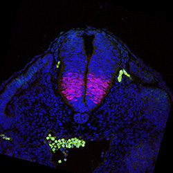 Protein expression in the human embryonic spinal cord