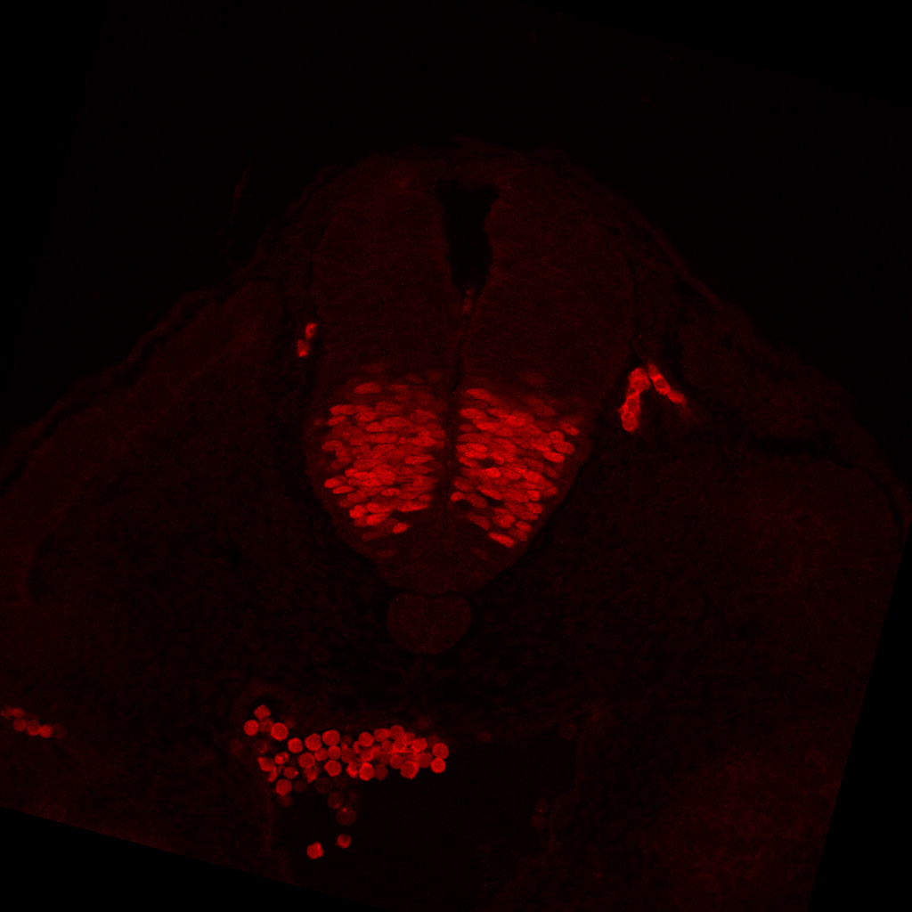 Protein expression in the human embryonic spinal cord