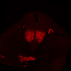 Protein expression in the human embryonic spinal cord