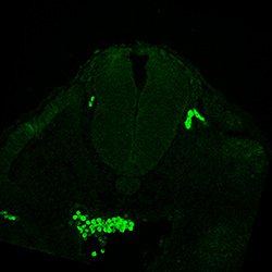 Protein expression in the human embryonic spinal cord