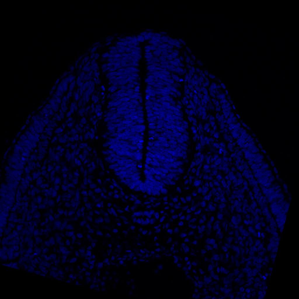 Protein expression in the human embryonic spinal cord
