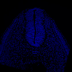 Protein expression in the human embryonic spinal cord