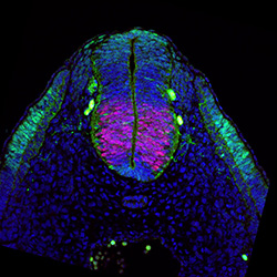 Protein expression in the human embryonic spinal cord