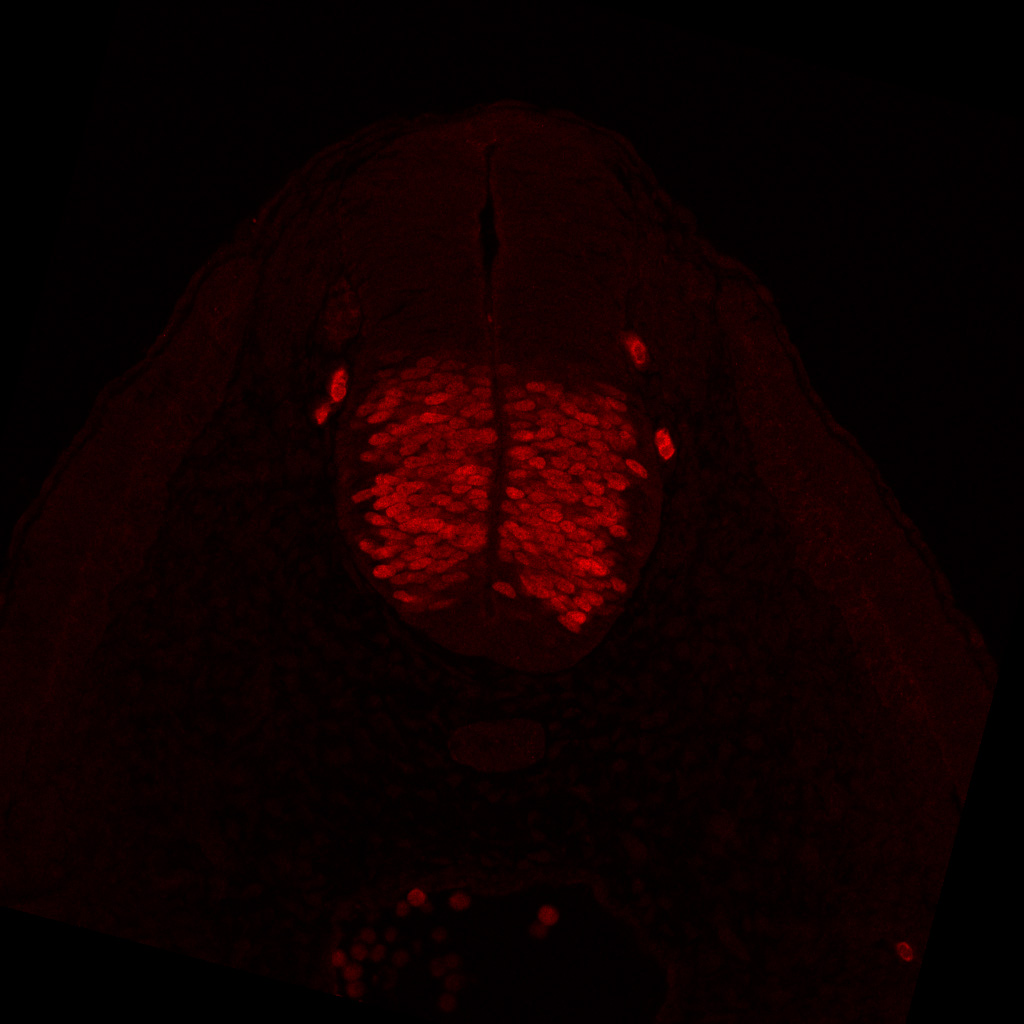 Protein expression in the human embryonic spinal cord