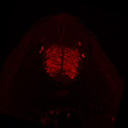 Protein expression in the human embryonic spinal cord