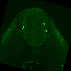 Protein expression in the human embryonic spinal cord