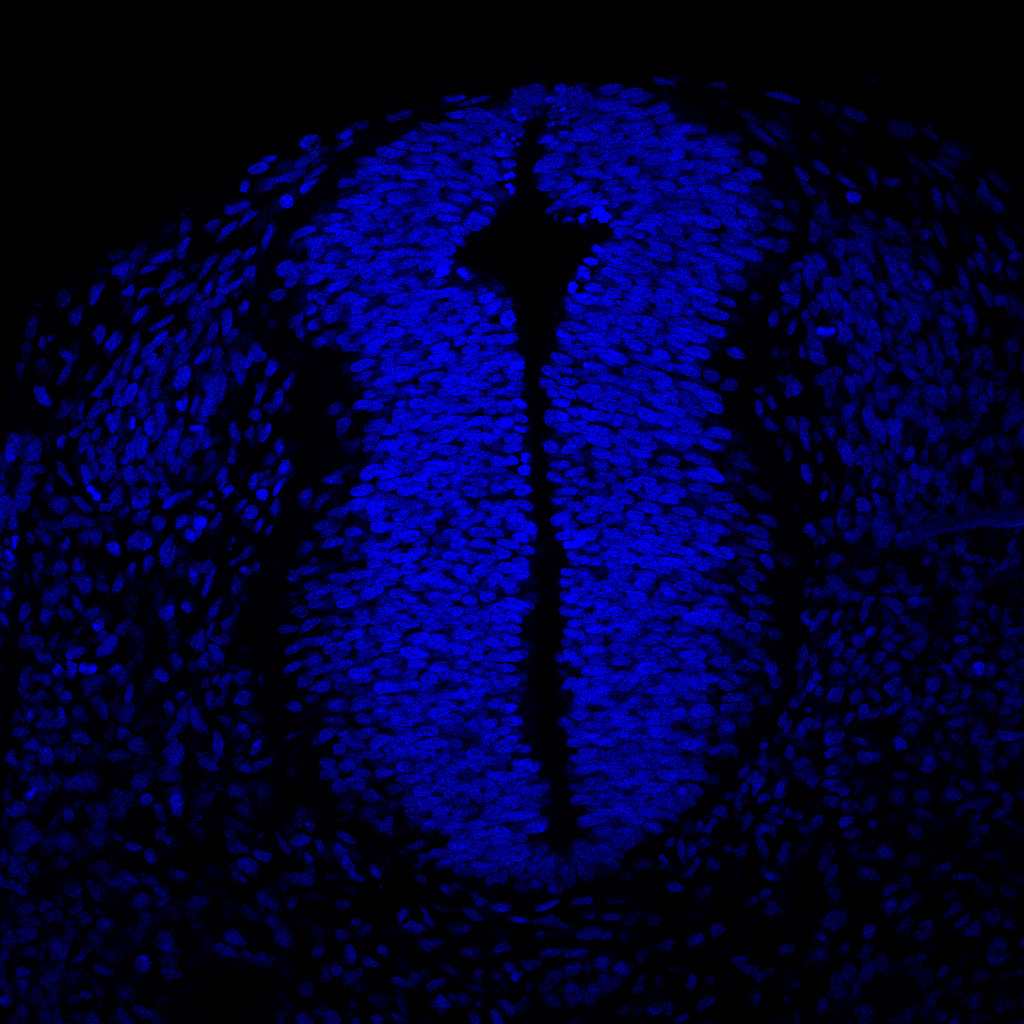 Protein expression in the human embryonic spinal cord