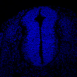 Protein expression in the human embryonic spinal cord