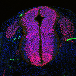 Protein expression in the human embryonic spinal cord