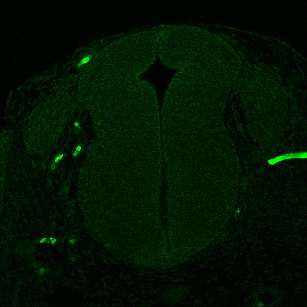 Protein expression in the human embryonic spinal cord