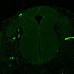 Protein expression in the human embryonic spinal cord