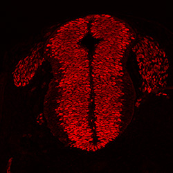 Protein expression in the human embryonic spinal cord
