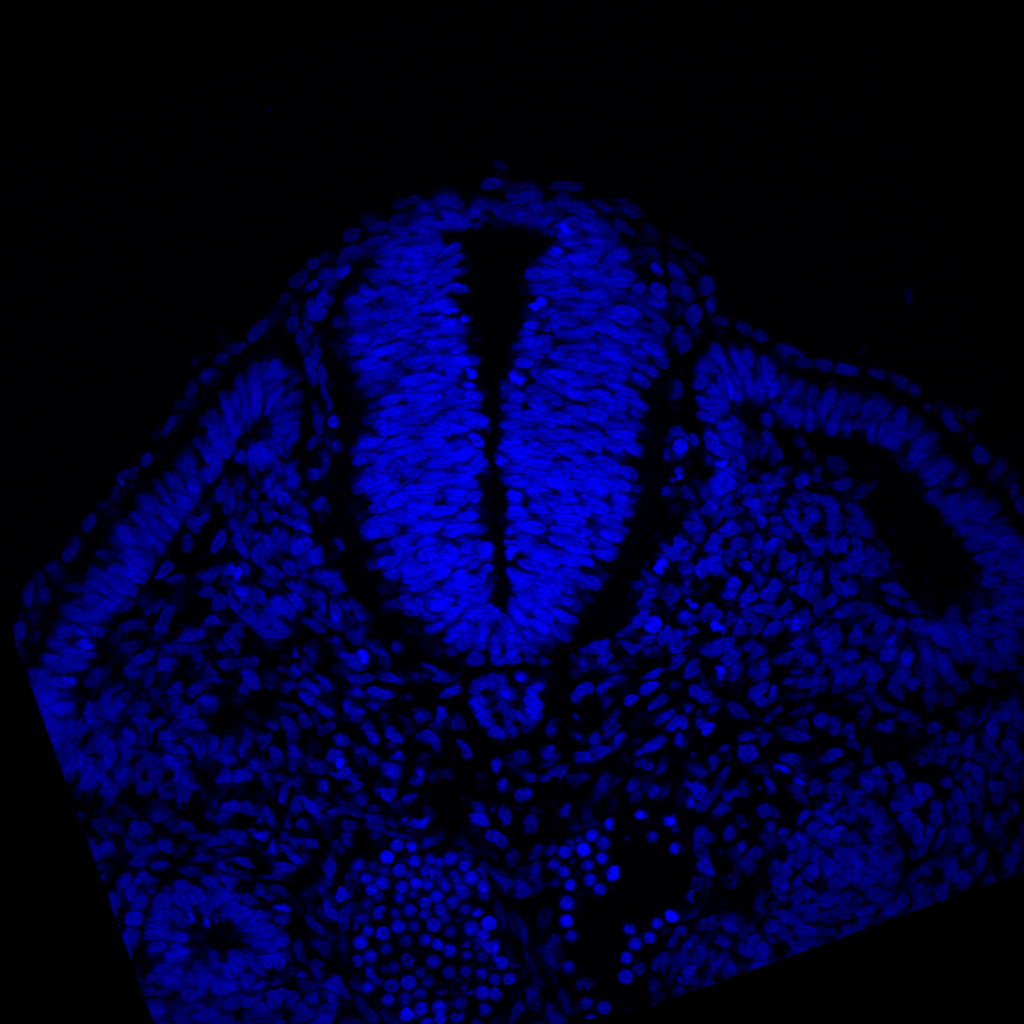 Protein expression in the human embryonic spinal cord