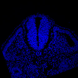 Protein expression in the human embryonic spinal cord