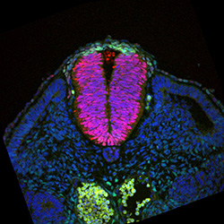 Protein expression in the human embryonic spinal cord