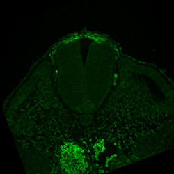 Protein expression in the human embryonic spinal cord
