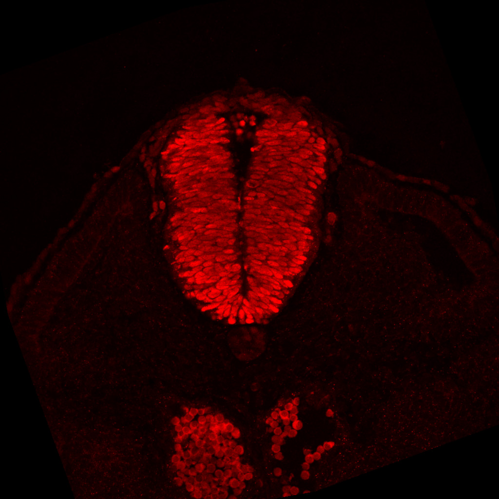 Protein expression in the human embryonic spinal cord