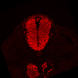 Protein expression in the human embryonic spinal cord