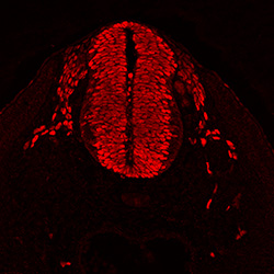 Protein expression in the human embryonic spinal cord