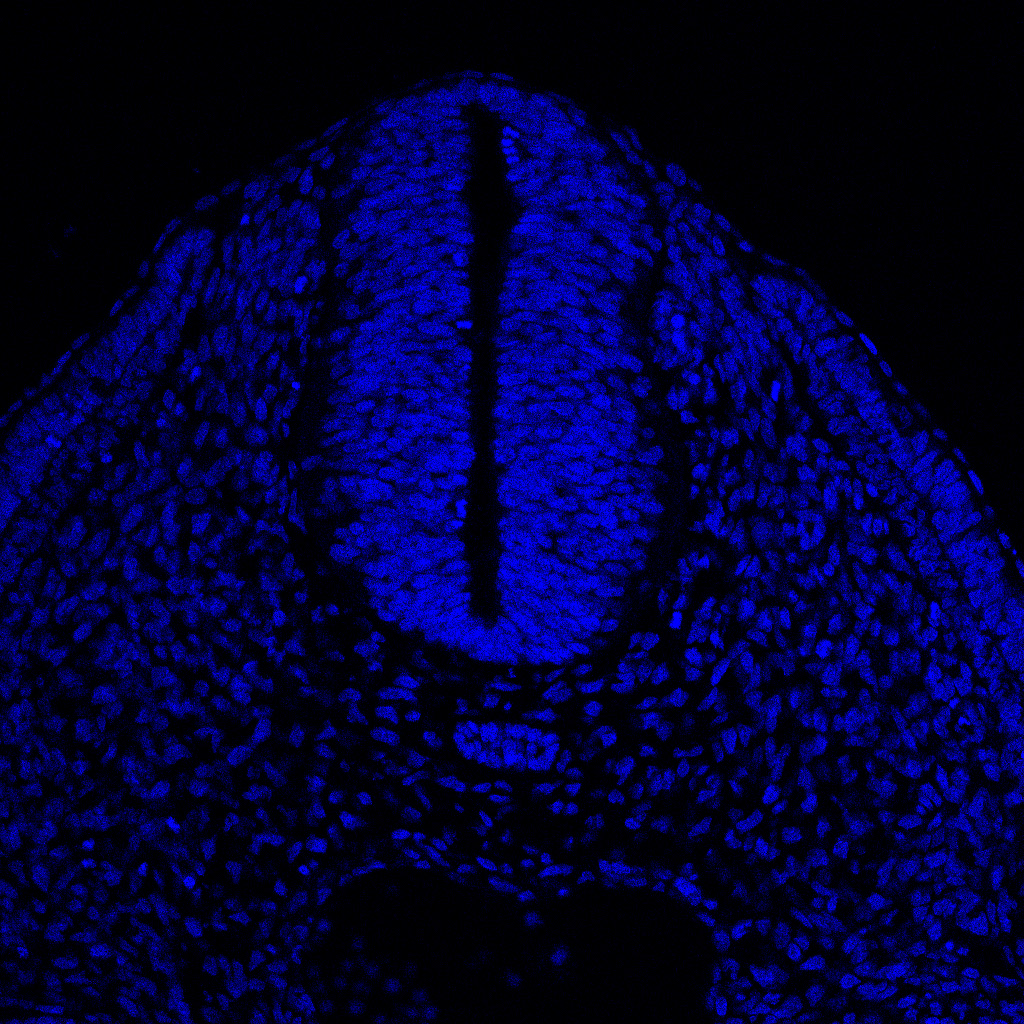 Protein expression in the human embryonic spinal cord