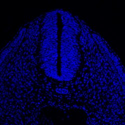 Protein expression in the human embryonic spinal cord