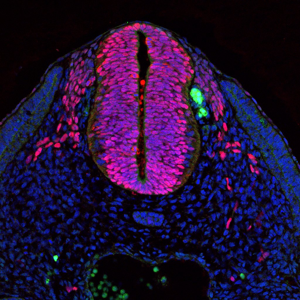 Protein expression in the human embryonic spinal cord