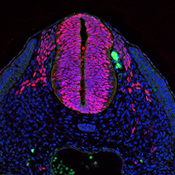 Protein expression in the human embryonic spinal cord