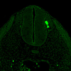Protein expression in the human embryonic spinal cord