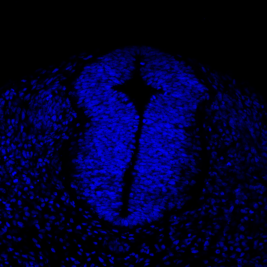 Protein expression in the human embryonic spinal cord
