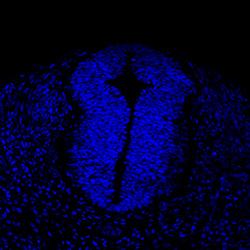 Protein expression in the human embryonic spinal cord
