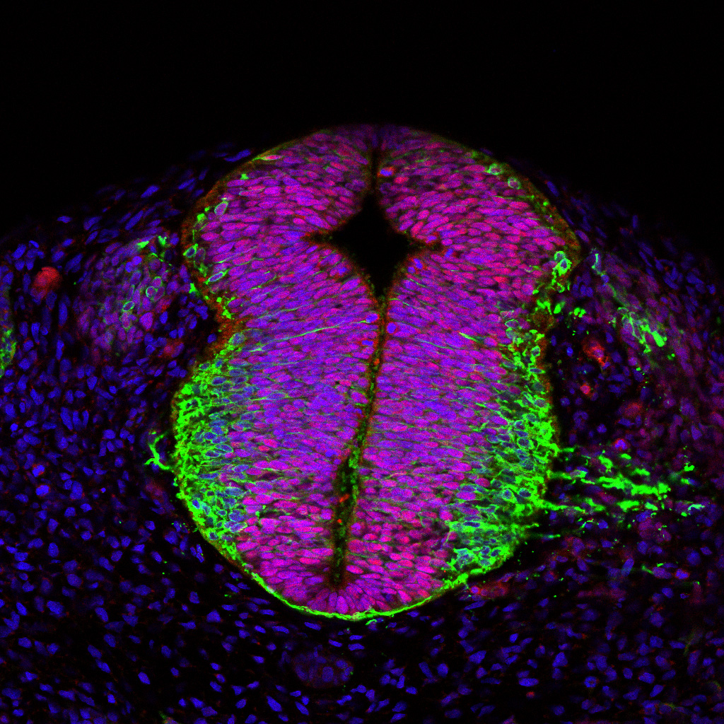 Protein expression in the human embryonic spinal cord