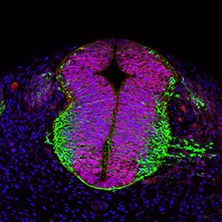 Protein expression in the human embryonic spinal cord
