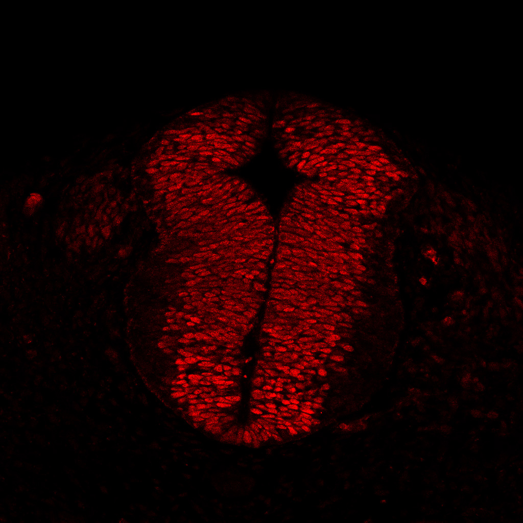 Protein expression in the human embryonic spinal cord