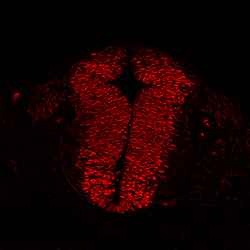 Protein expression in the human embryonic spinal cord